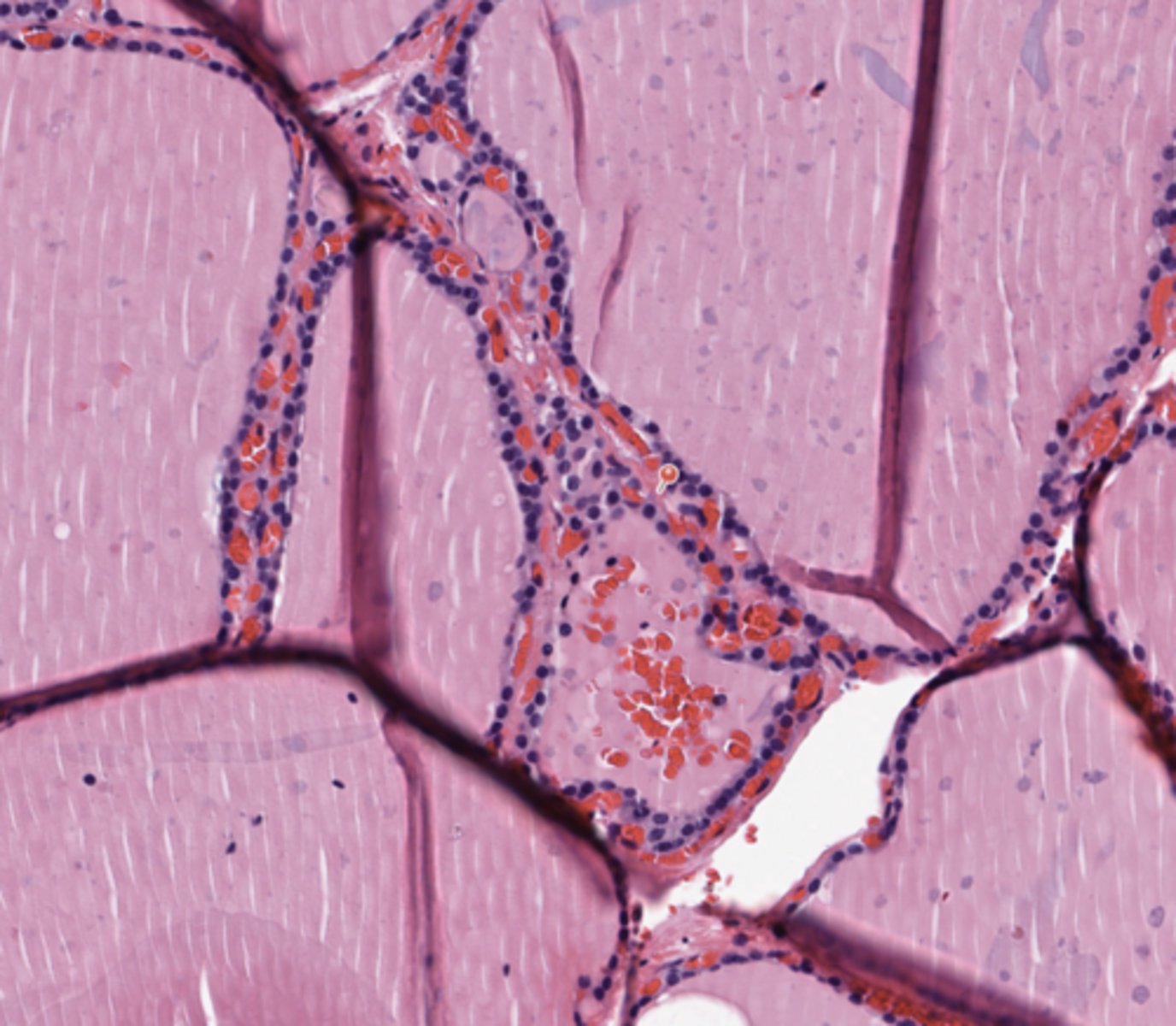 <p>Thyroid</p>