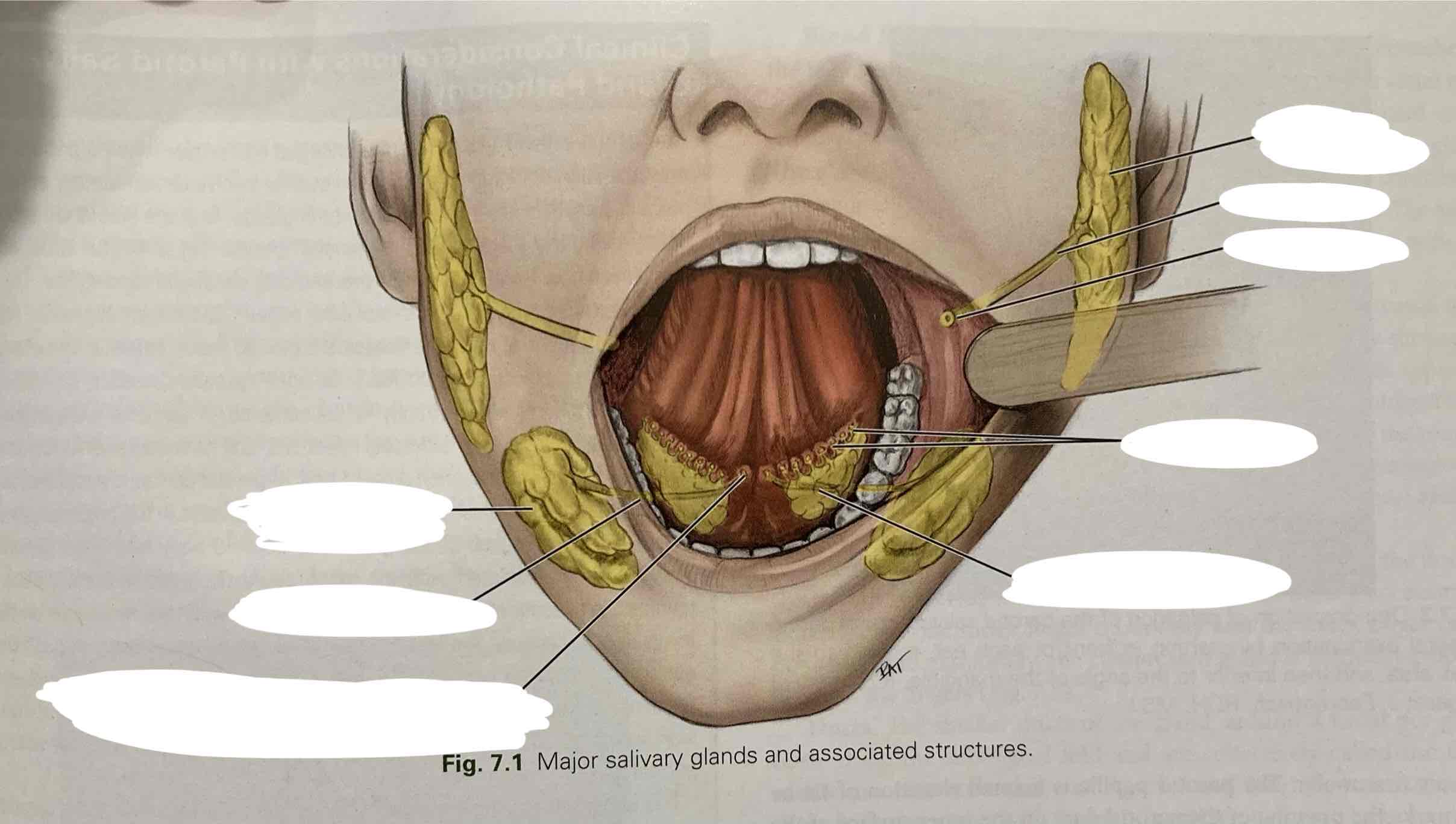 <p>32-39.) Utilize the diagram and key to label the salivary glands and related anatomy-identifying structures.</p><ul><li><p>Parotid duct</p></li><li><p>Parotid salivary gland</p></li><li><p>Parotid papilla</p></li><li><p>Sublingual ducts</p></li><li><p>Sublingual salivary gland</p></li><li><p>Submandibular duct</p></li><li><p>Submandibular salivary gland</p></li><li><p>Sublingual caruncle with duct opening from submandibular and sublingual glands</p></li></ul><p></p>