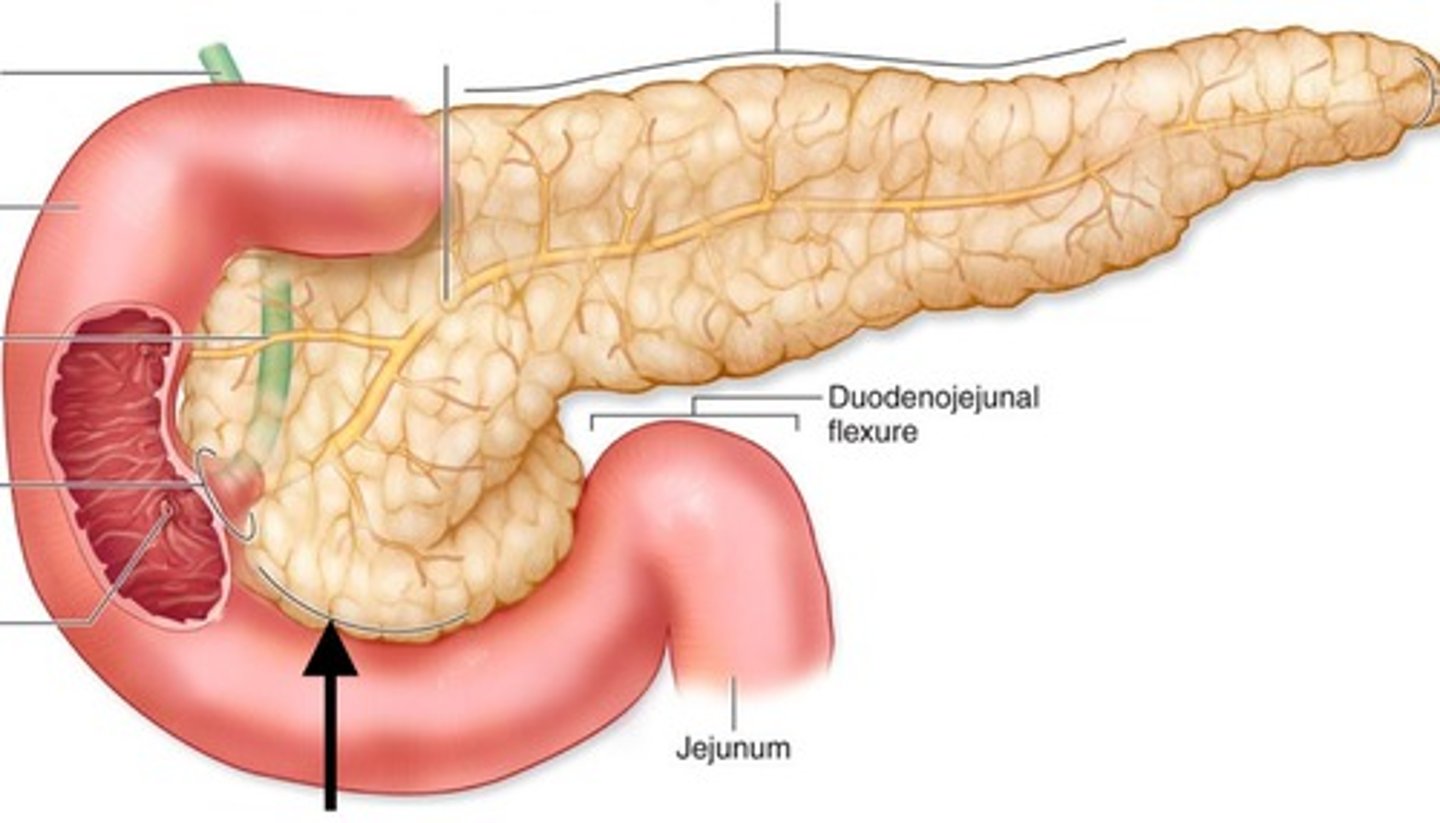 <p>What part of the pancreas is this?</p>