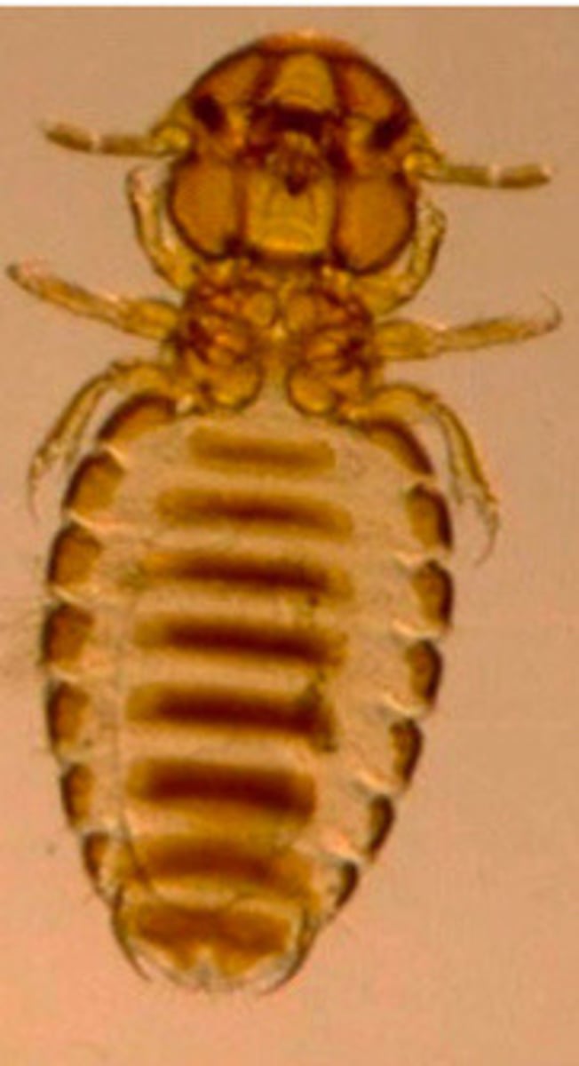 <p>What type of lice is this?</p>