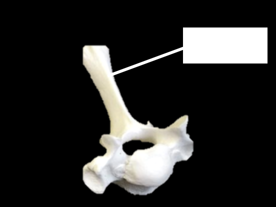 <p>bone </p>