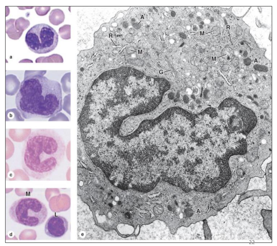 <p>What type of cell is seen here?</p>