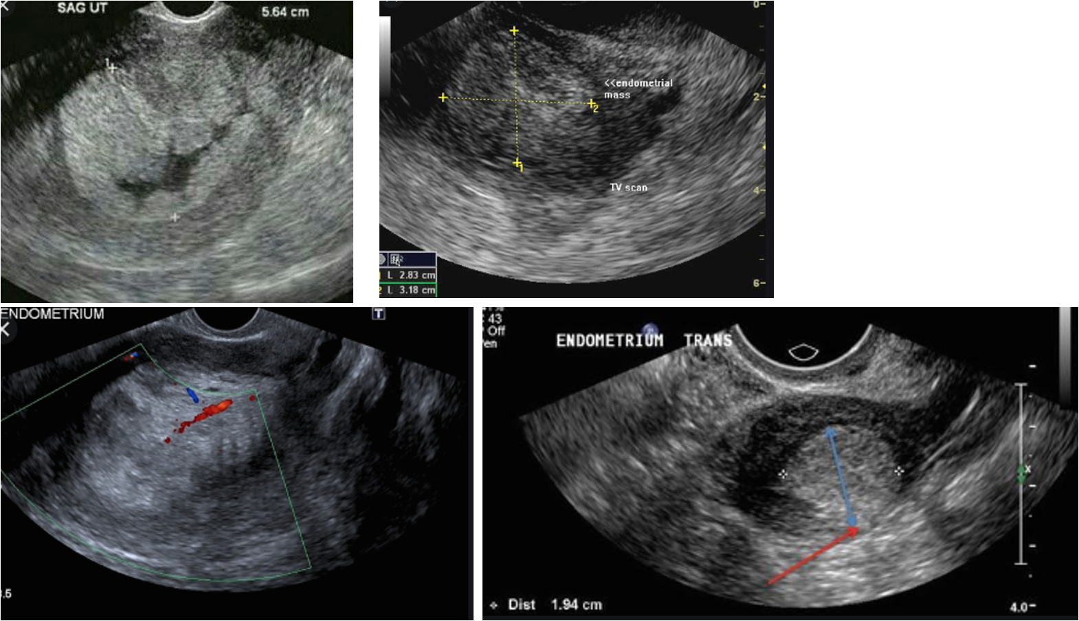 <p>what is this pathology?</p>