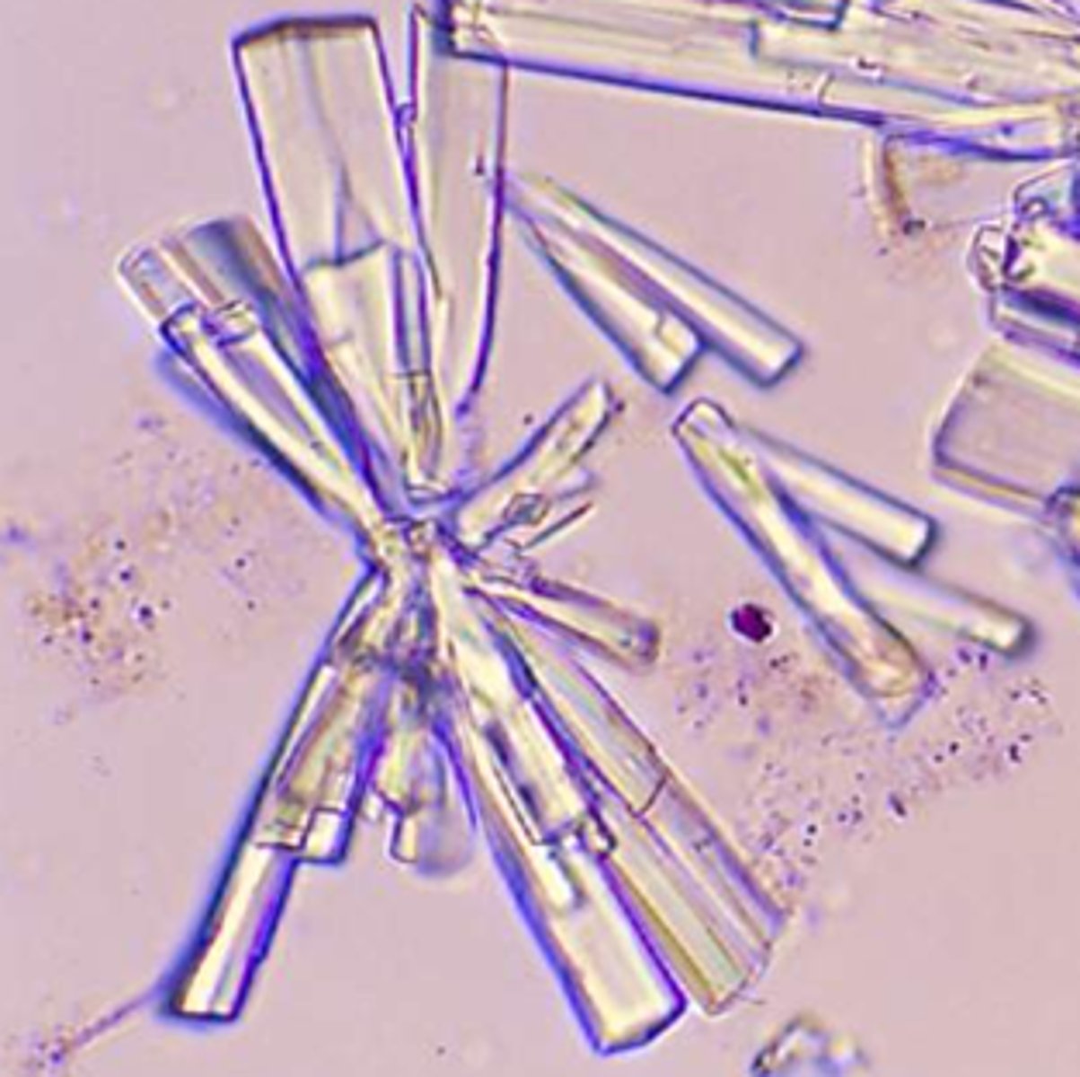 <p>Found in alkaline urine <br>Prisms, tapered at one end</p>