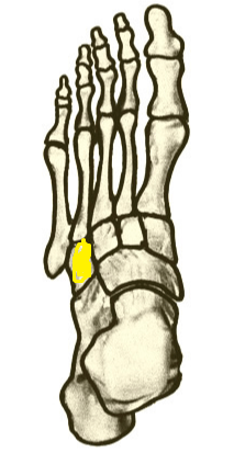 Name the highlighted foot bone