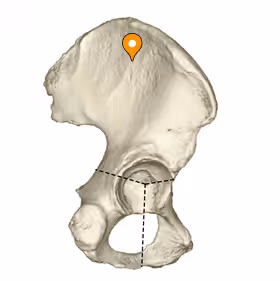 <p>The fan shaped portion of the ilium</p>