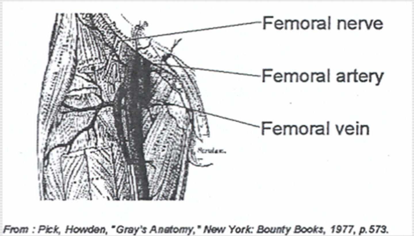 <p>-Patient supine, legs extended</p><p>-Palpate artery 2 fingerbreaths below inguinal ligament -Vein 1 cm medial to artery</p><p>-NAVY mnemonic</p>
