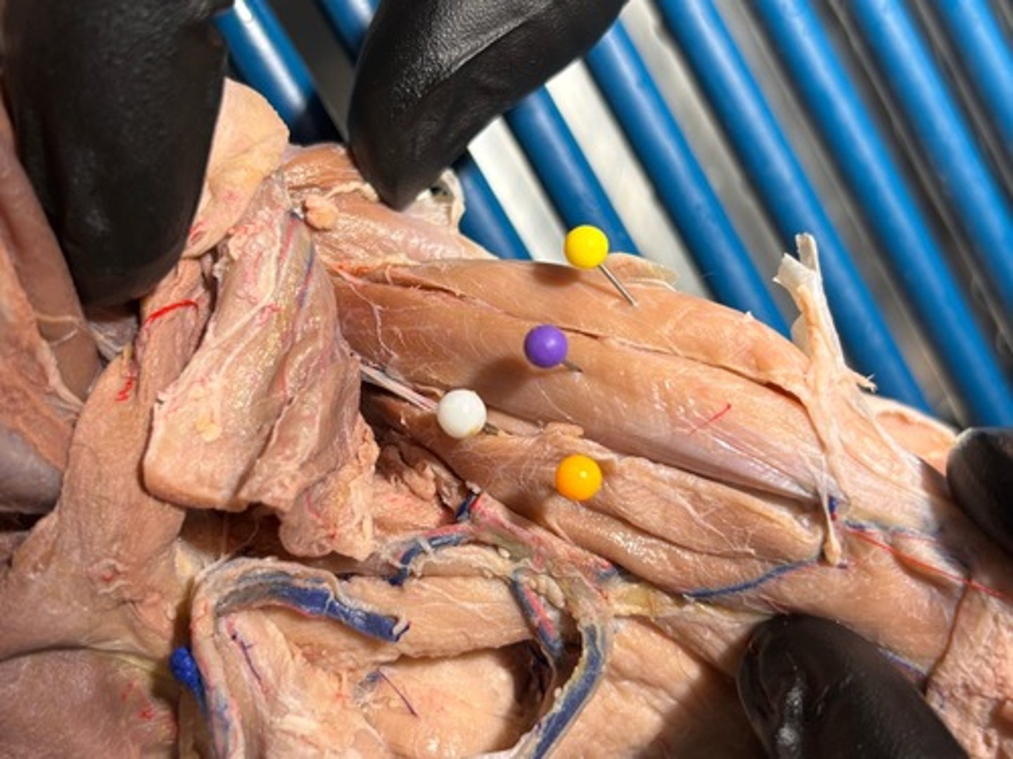 <p>What quadricep muscle is the purple pin in</p>