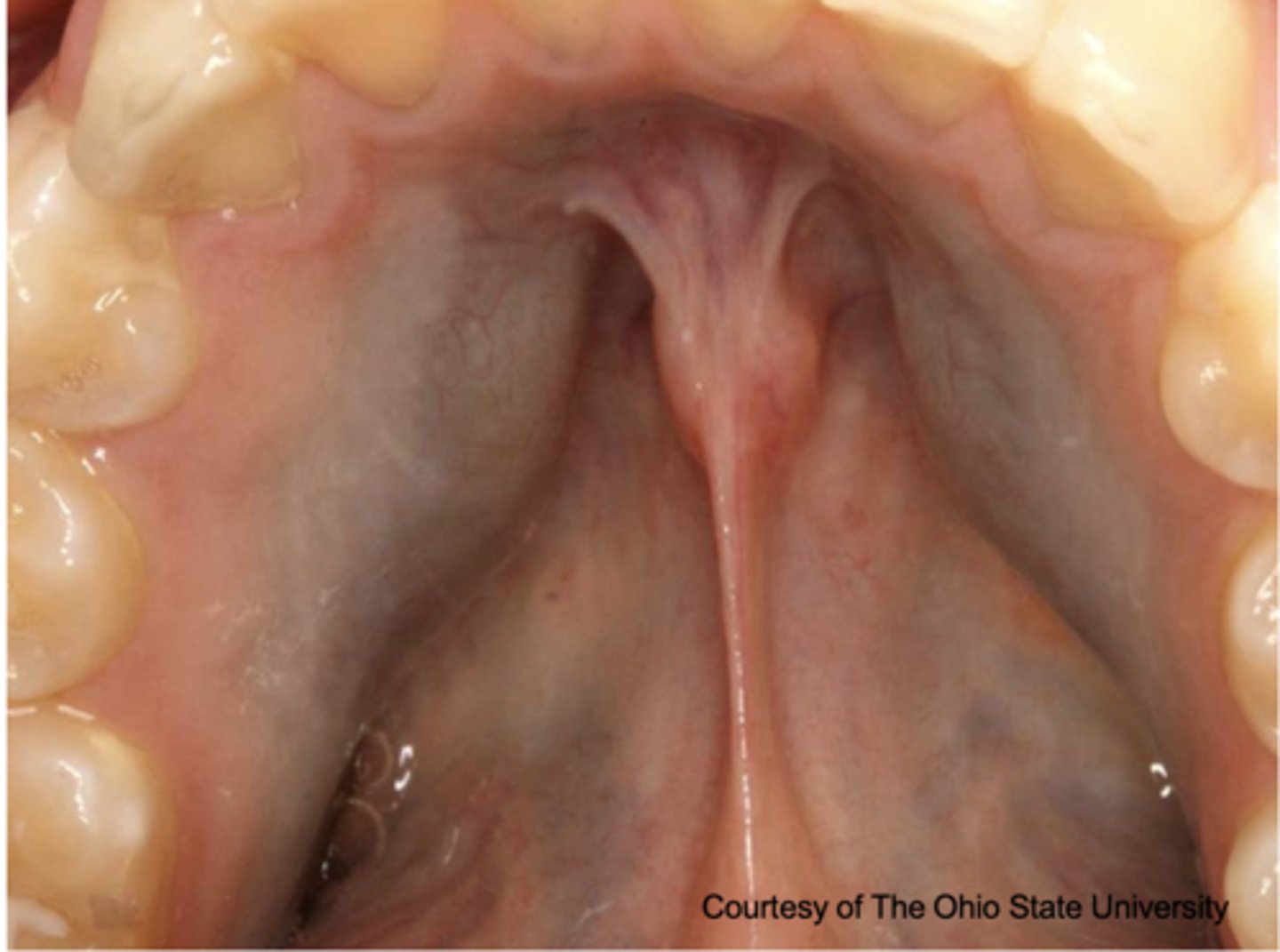 <p>What type of pigmented lesion?</p>