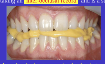 <p>You can record a dentate patient’s jaw relationship by asking them to bite on a layer of soft material between the upper and lower teeth and letting it set </p><p><strong>static </strong>position </p>