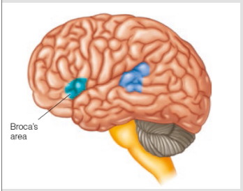 <p><strong>BROCA’S AREA</strong></p>