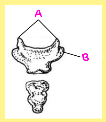 <p><u>Name the following</u>:</p><ul><li><p>Bone?</p></li><li><p>Side?</p></li><li><p>View?</p></li><li><p>Specific Surface? (if applicable)</p></li><li><p>A?</p></li></ul><p></p>