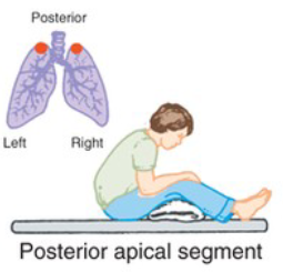<p>What CPT position is pictured, and when is it used?</p>