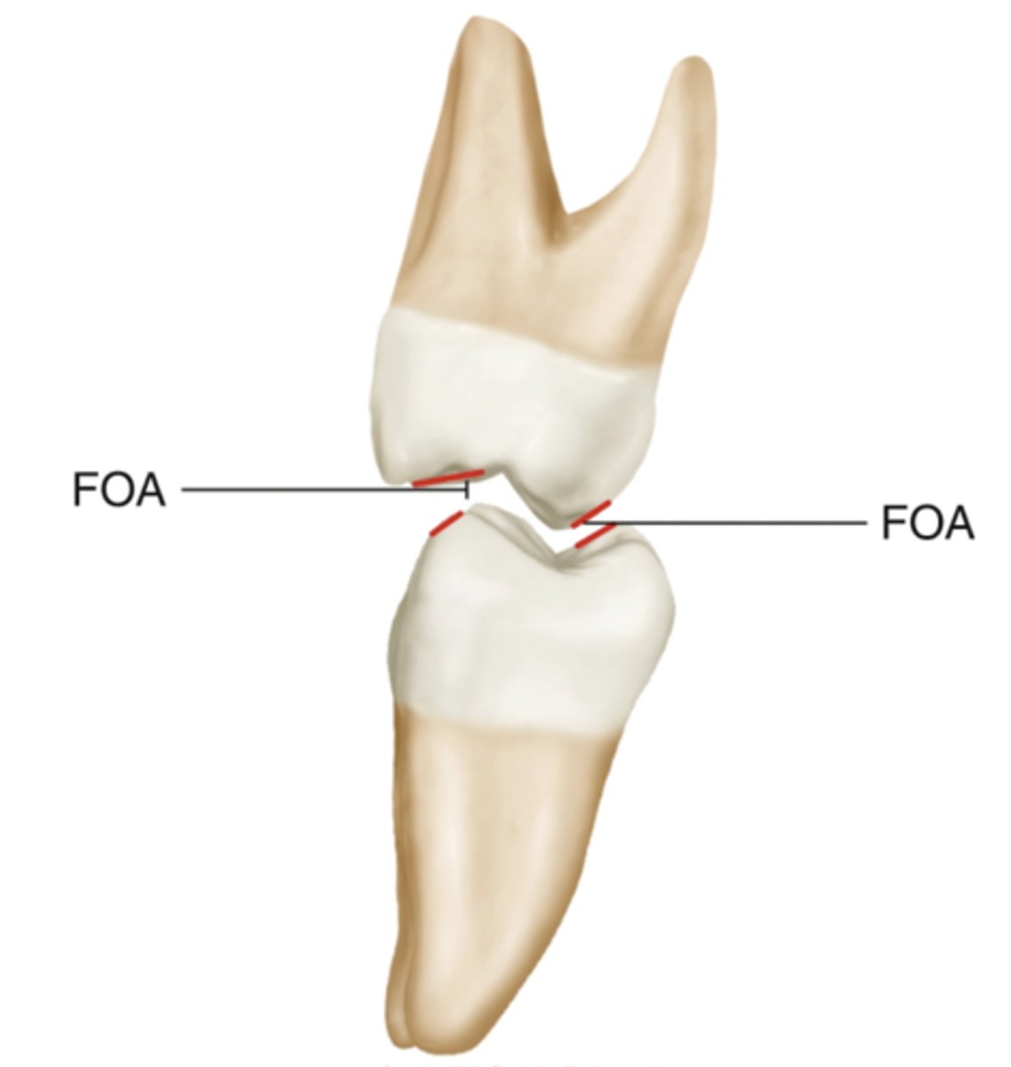 <p>What does FOA stand for in relation to noncentric cusps?</p>