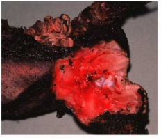 <p>Cause of this muscle pigmentation</p>