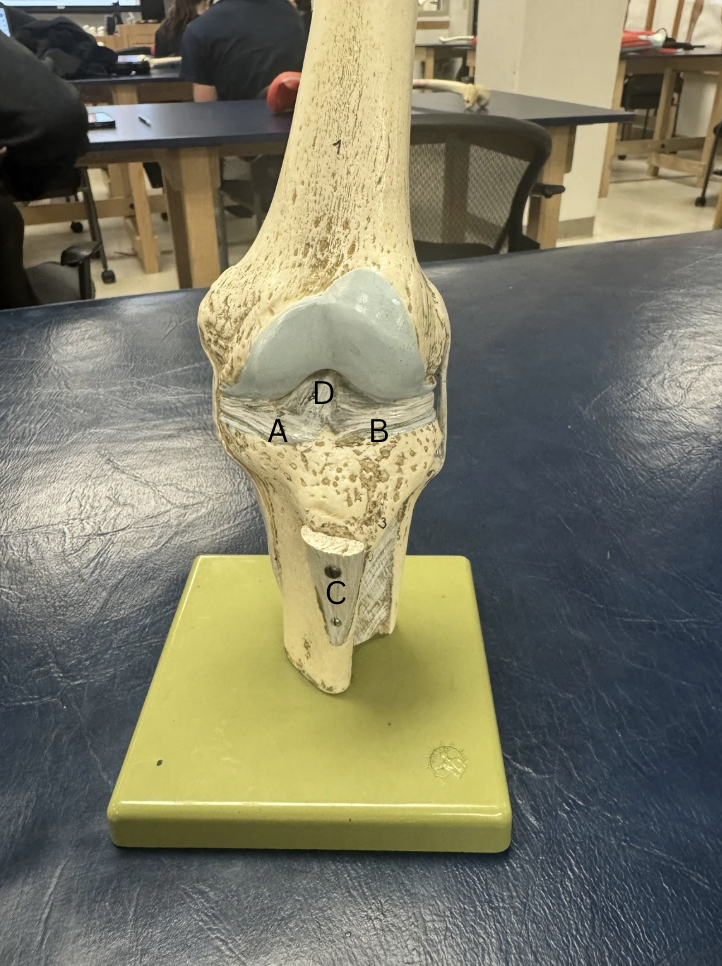 <p>Label the menisci and ligaments </p>