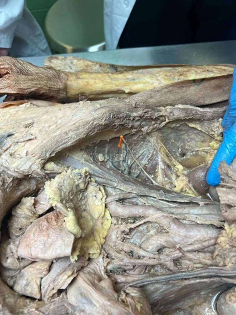 <p>iliacus muscle</p>