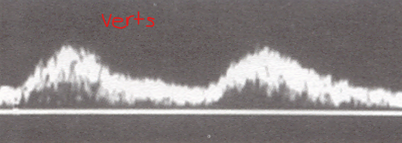 <p>Identify this image. </p>