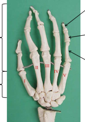 <p>What is the top right black arrow pointing to? </p>