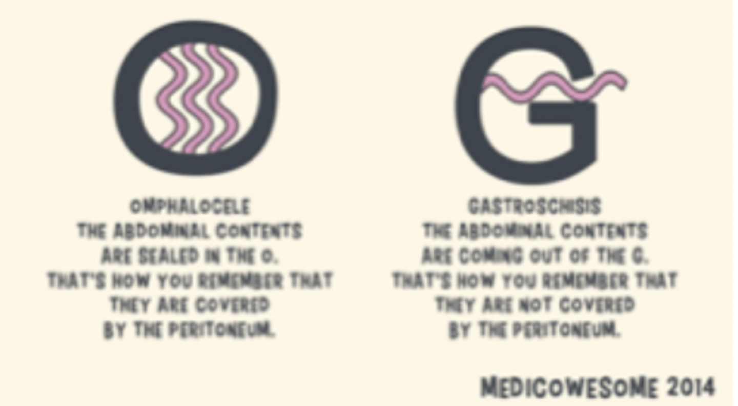 <p>omphalocele</p><p>- cardiac abnormalities</p><p>- neural tube defects</p><p>- chromosomal defects</p><p>gastroschisis</p><p>- SGA</p><p>- increased malrotation risk</p>