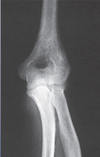 <p>What is the projection, anatomy and position shown? </p>