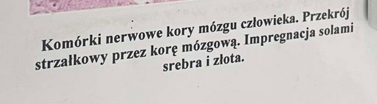 <p>zmielinizowane włókna, połączone w sieć co tworzy szlaki</p>