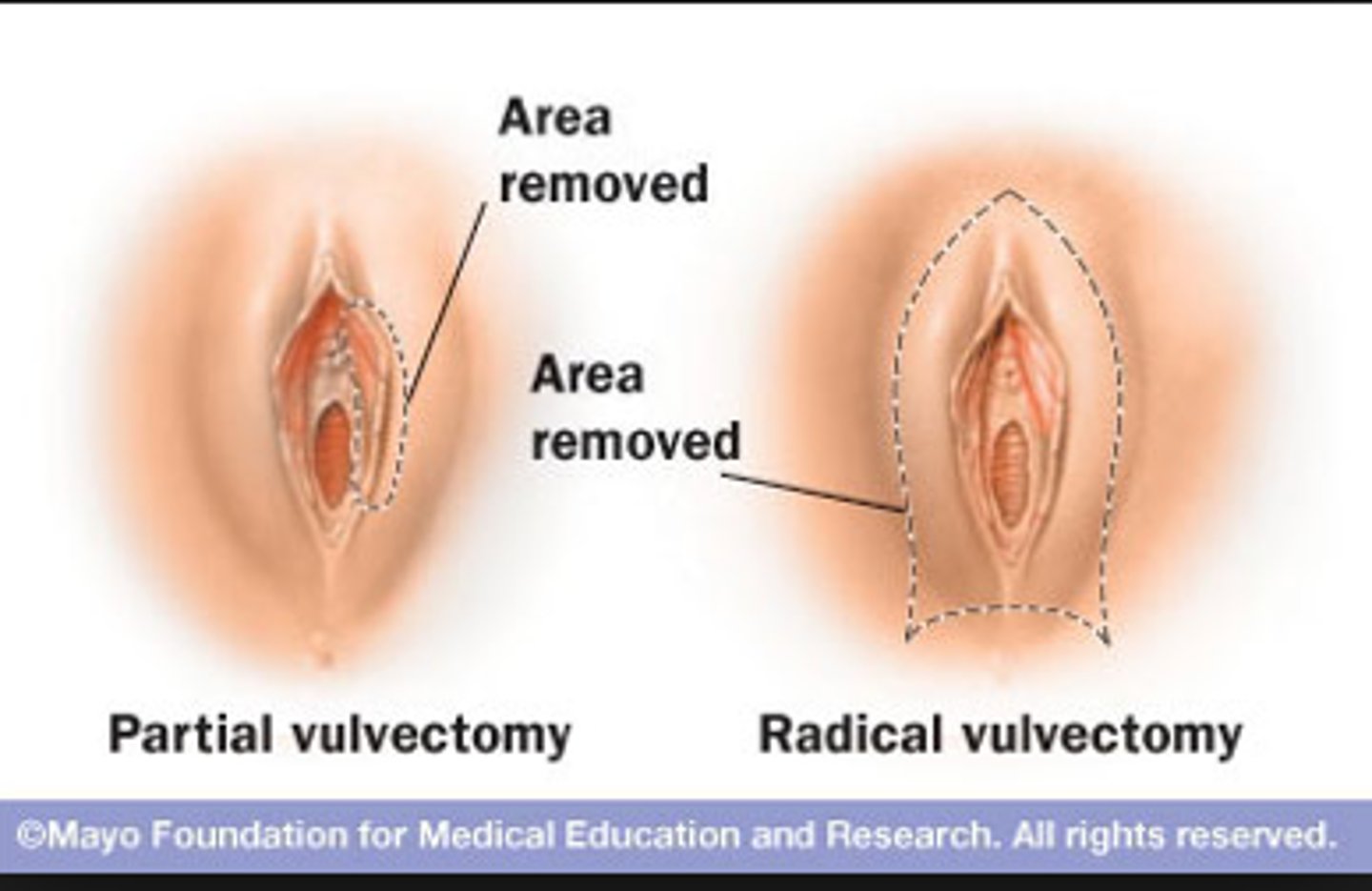 <p>vulva</p>