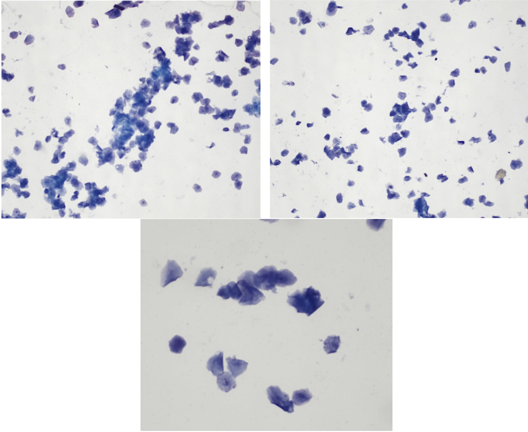 <p>Utstryk 1<br>Parabasalceller: <br>Intermediärceller: <br>Superficialceller: <br>Erytrocyter: <br>Neutrofiler:</p><p>Stadium:</p>