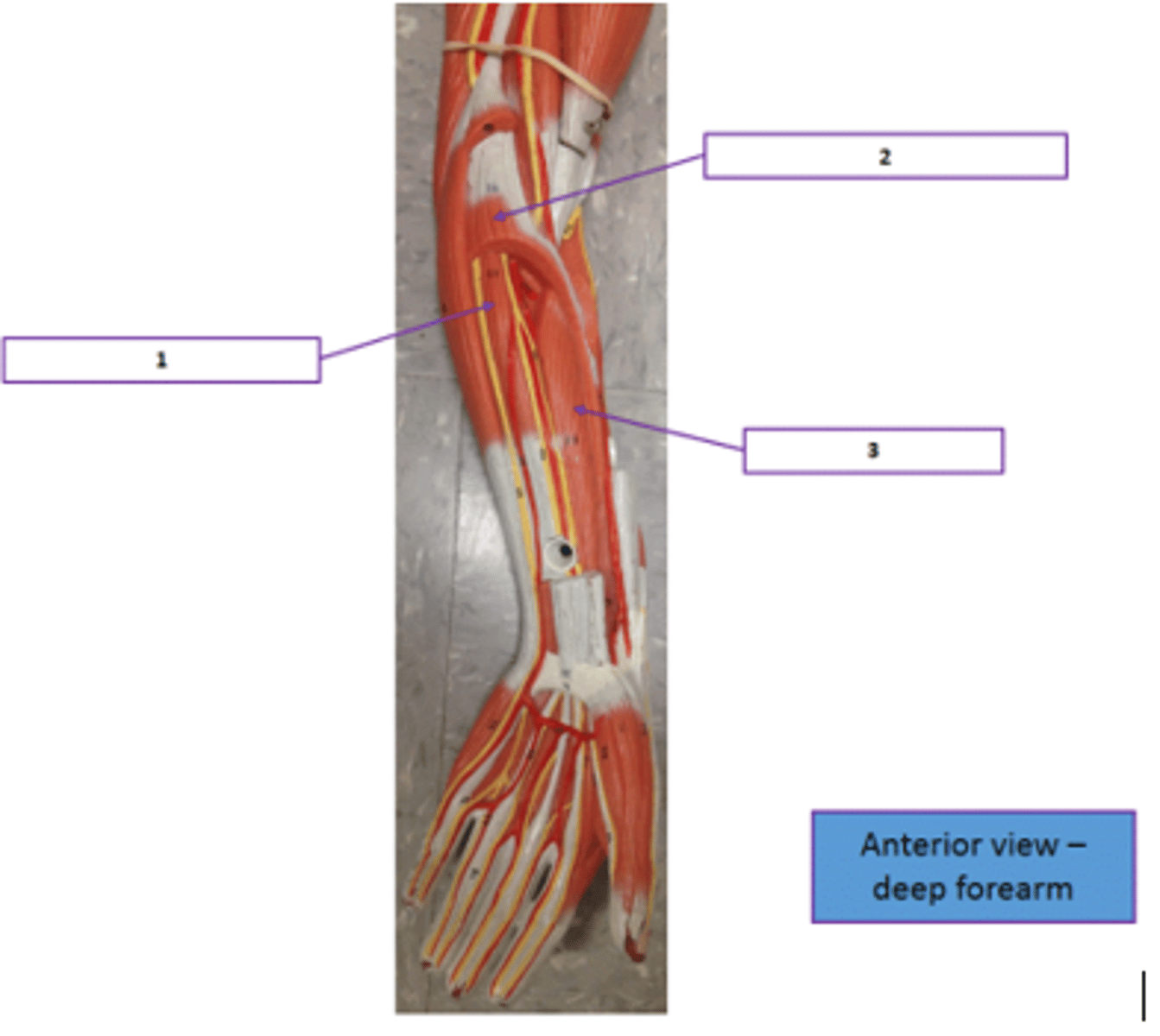 <p>Identify the muscle labeled 1.</p>