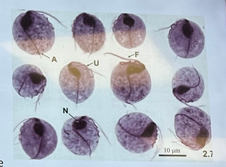 <p>Name this parasite:<br>Def Host: Humans<br>Int Host: None<br>Target Organ: urogential tract<br>Infectious stage: trophozoite </p>