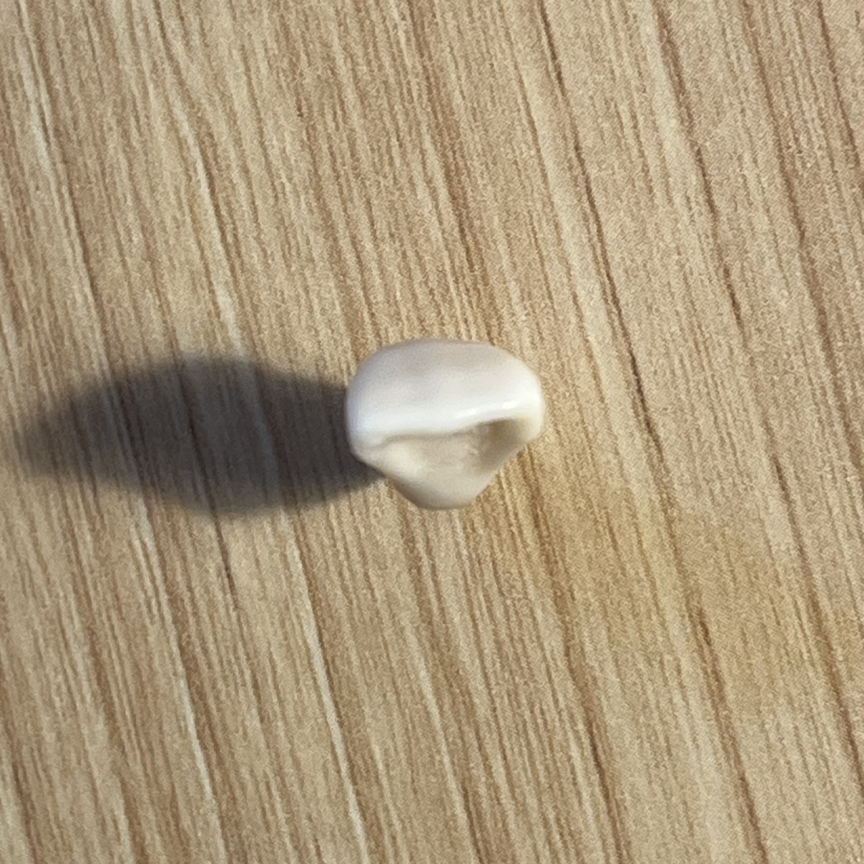 <p>What tooth is this (with view)?</p>