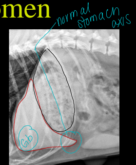 <p>Normal Abdomen Liver on Radiographs </p>