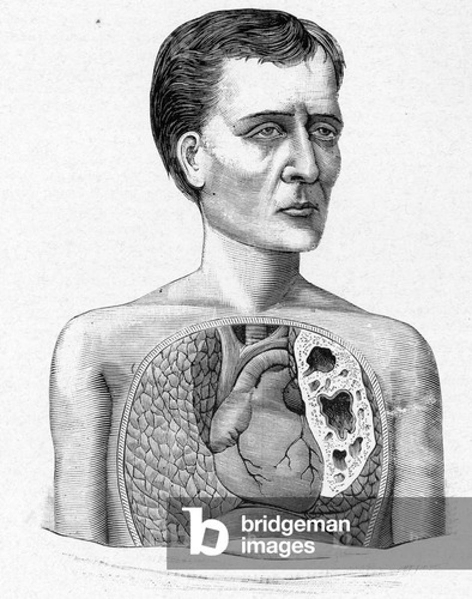 <p>this body which haboured the disease</p>
