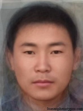 <p>Identify this Phenotype </p>