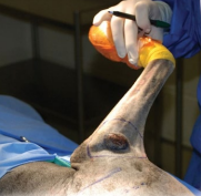 <p>Surgery</p>