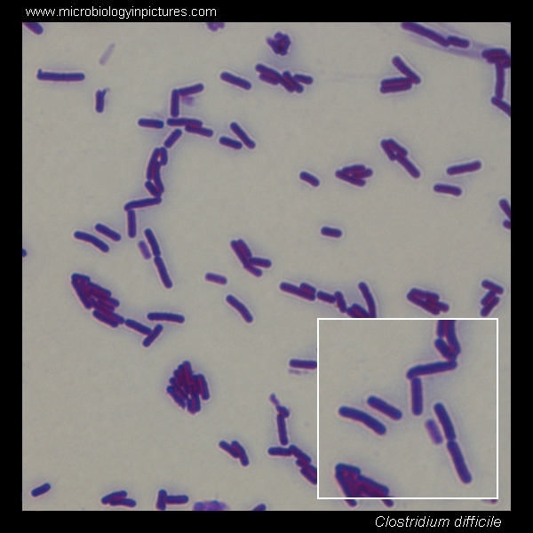 Clostridium difficile