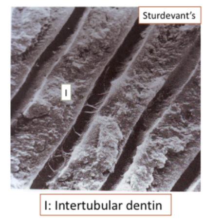 <p><span style="font-size: calc(var(--scale-factor)*21.96px);">Dentin between peritubular dentin</span><br><span style="font-size: calc(var(--scale-factor)*18.72px);"> </span><span style="font-size: calc(var(--scale-factor)*21.96px);">Represents most of the tooth</span><br><span style="font-size: calc(var(--scale-factor)*18.72px);"> </span><span style="font-size: calc(var(--scale-factor)*21.96px);">Less calcified.</span><br><span style="font-size: calc(var(--scale-factor)*18.72px);"> </span><span style="font-size: calc(var(--scale-factor)*21.96px);">Composed of apatite crystallites</span><br><span style="font-size: calc(var(--scale-factor)*21.96px);">embedded in collagen matrix between</span><br><span style="font-size: calc(var(--scale-factor)*21.98px);">tubules.</span></p>