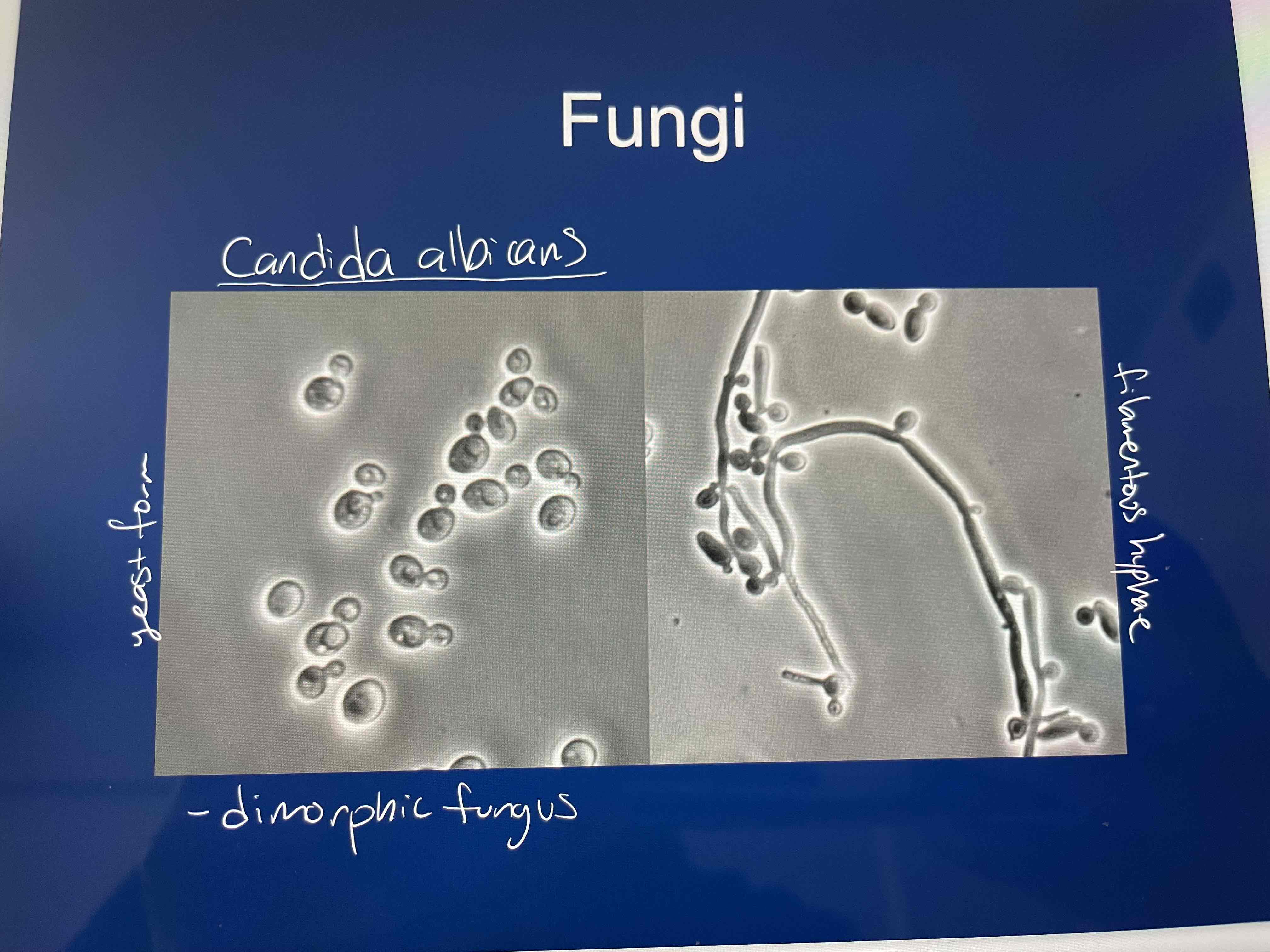 <ul><li><p><em><mark data-color="red" style="background-color: red; color: inherit">Candida albicans</mark></em></p><ul><li><p>“white yeast”</p></li></ul></li><li><p><em><mark data-color="red" style="background-color: red; color: inherit">Cryptococcus neoformans</mark></em></p><ul><li><p>“Causes lung infections”</p></li></ul></li></ul><p></p>