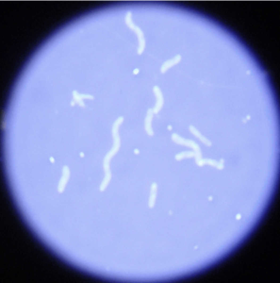 <p>spiral shaped bacteria</p>