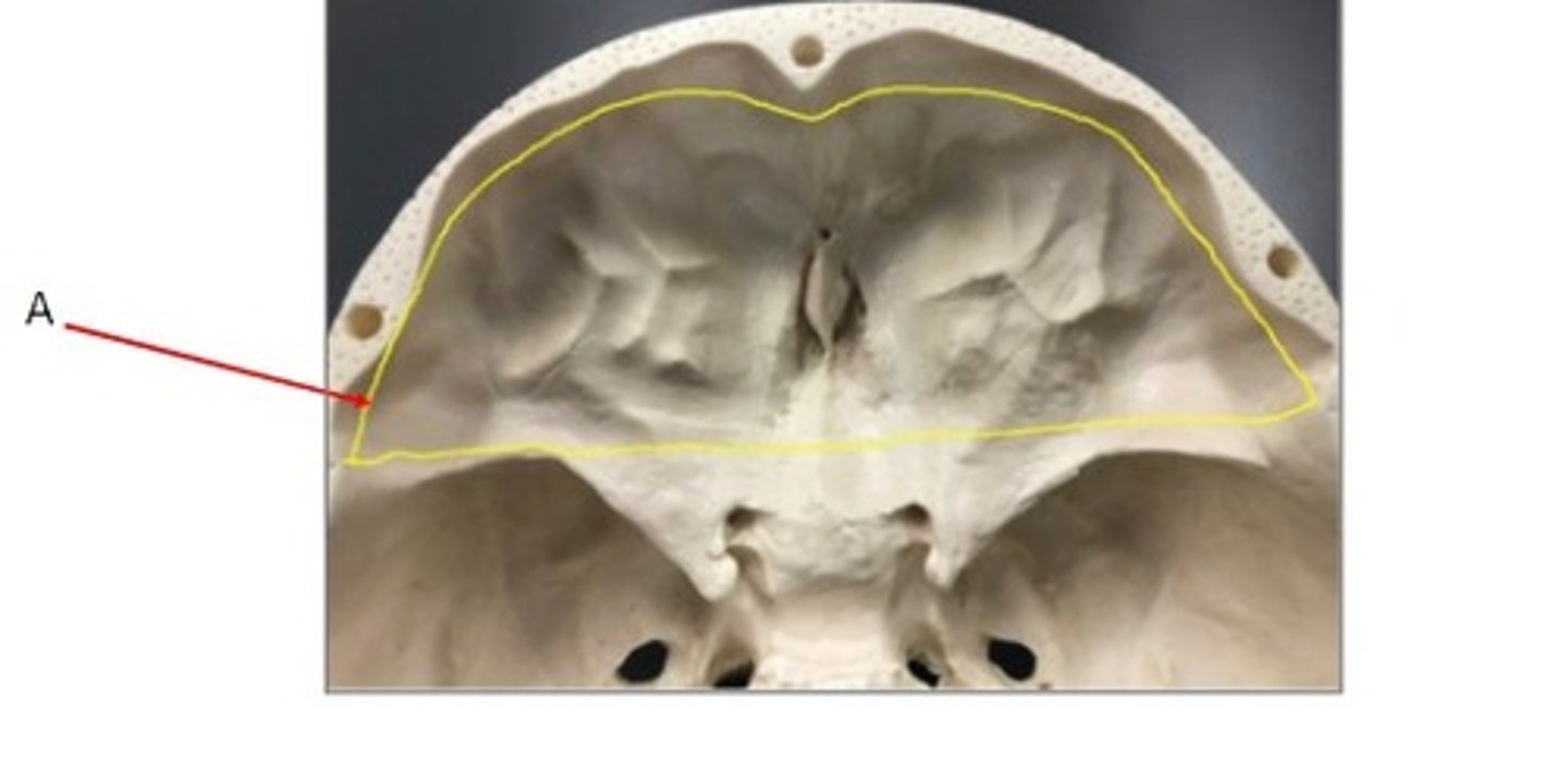 <p>What category of bone is it? What bone is it? Label the structures.</p>