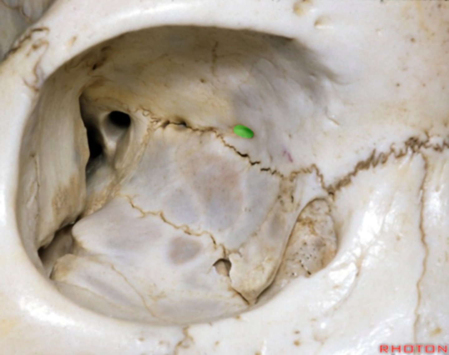 <p>Opening for nerves and vessels at the front.</p>