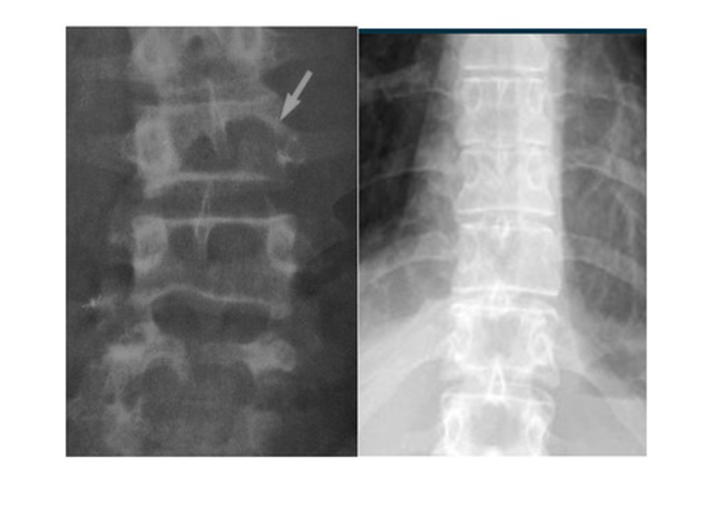 <p>What anomaly is this?</p>