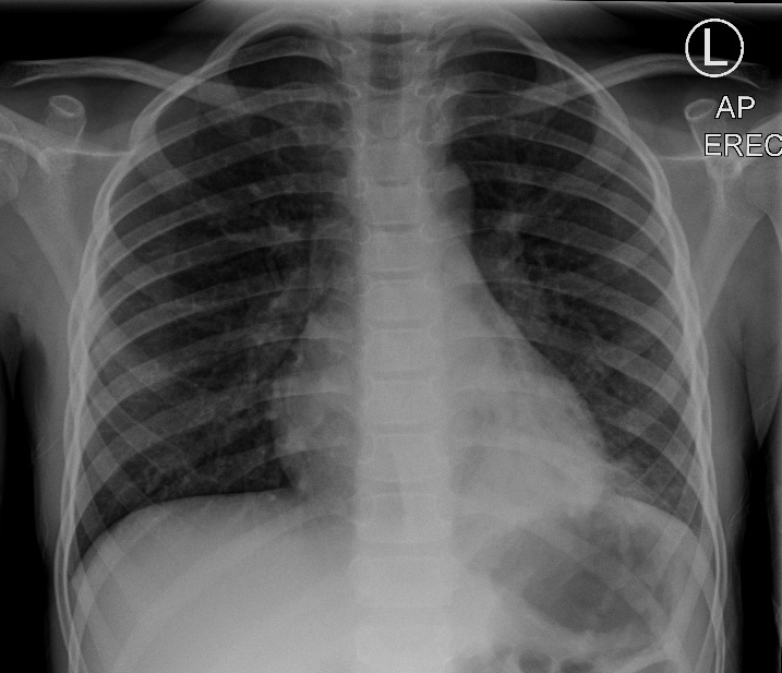 <p>Identify this pathology and patient’s symptoms</p>