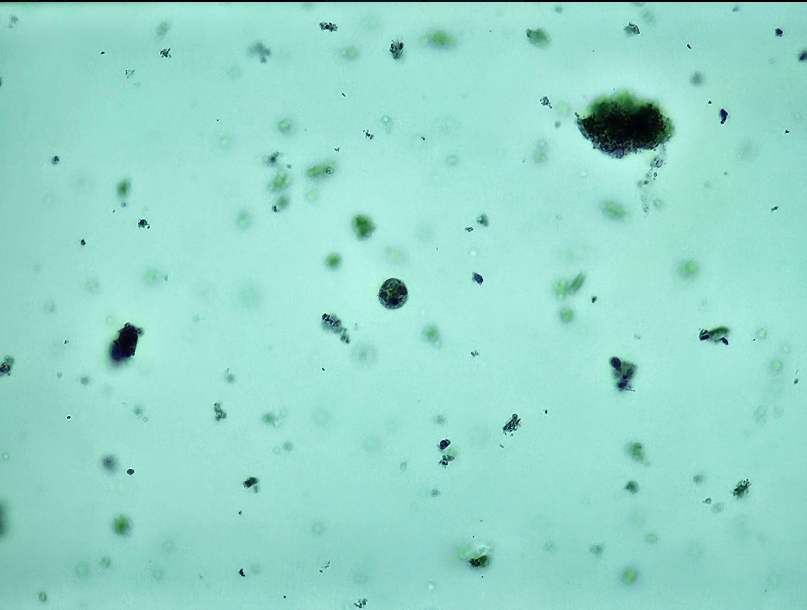 <p><span data-name="microscope" data-type="emoji">🔬</span><span data-name="petri_dish" data-type="emoji">🧫</span><strong><span> </span>Na podstawie zdjęcia preparatu:</strong></p><p></p><ul><li><p><span data-name="book" data-type="emoji">📖</span><span> </span>rozpoznaj gatunek pasożyta;</p></li></ul><p></p><ul><li><p><span data-name="recycle" data-type="emoji">♻</span><span> </span>rozpoznaj wszystkie formy rozwojowe;</p></li></ul><p></p><ul><li><p><span data-name="microbe" data-type="emoji">🦠</span><span> </span>wskaż organelle i cechy charakterystyczne dla danego gatunku;</p></li></ul><p></p><ul><li><p><span data-name="mask" data-type="emoji">😷</span><span> </span>nazwij chorobę, którą pasożyt wywołuje.</p></li></ul><p></p>