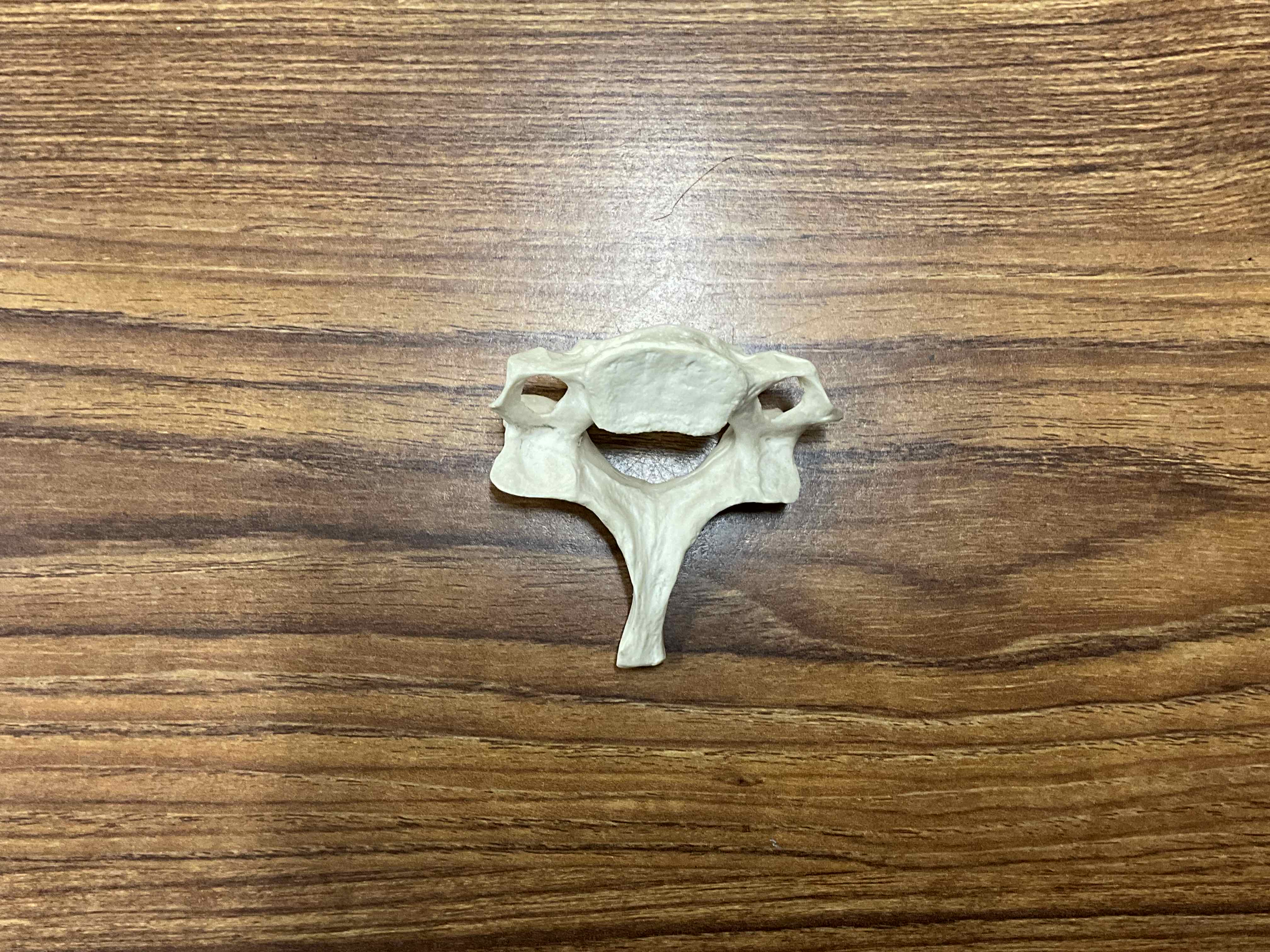 <p>Name this bone (not specific)</p>