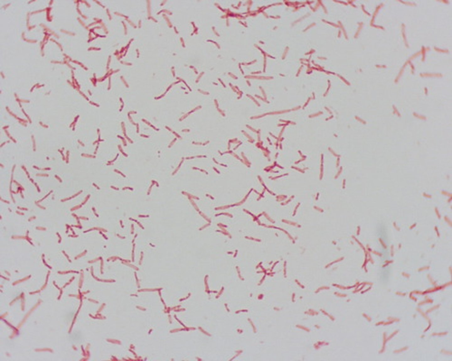 <p>Stool culture</p>