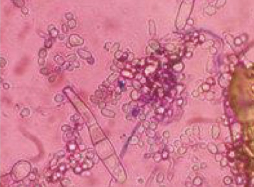 Identify this parasite.