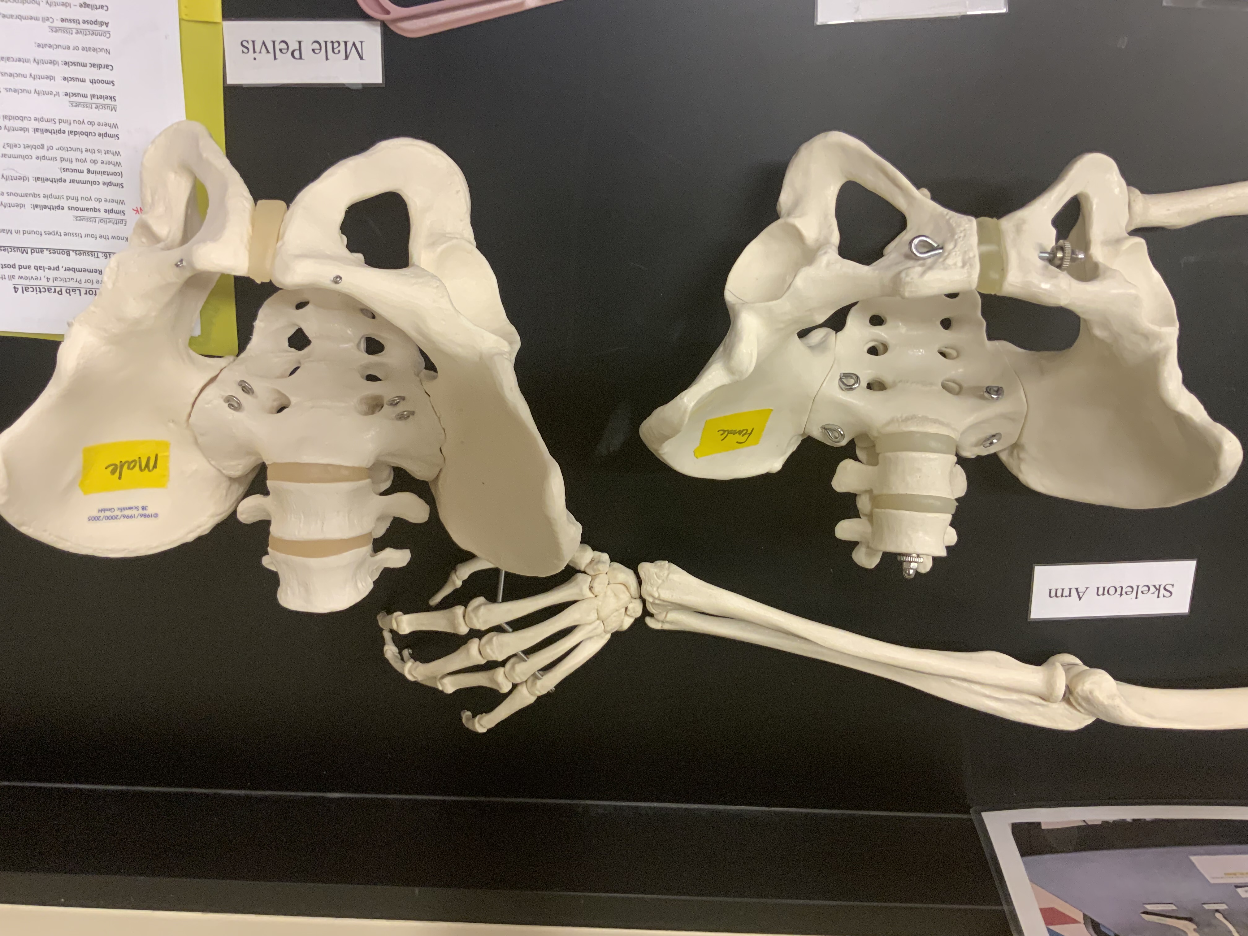 <ul><li><p>which pelvis is male (left or right)</p></li></ul>