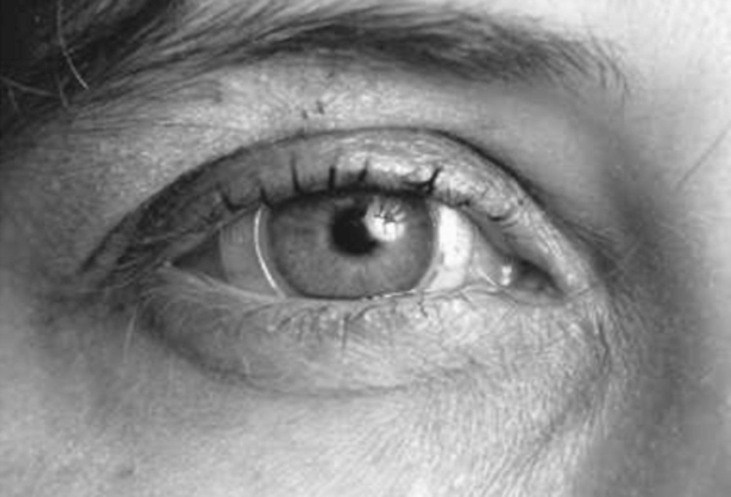 <p>small silicone annulus lens with a wire in it is placed on the eye and patient is put in magnetic field → when the eye moves the coil, a voltage is created that is proportional to the sine of the angle between the plane of the eye coil and direction of the magnetic field</p>