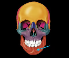 <p>lower jaw bone</p>